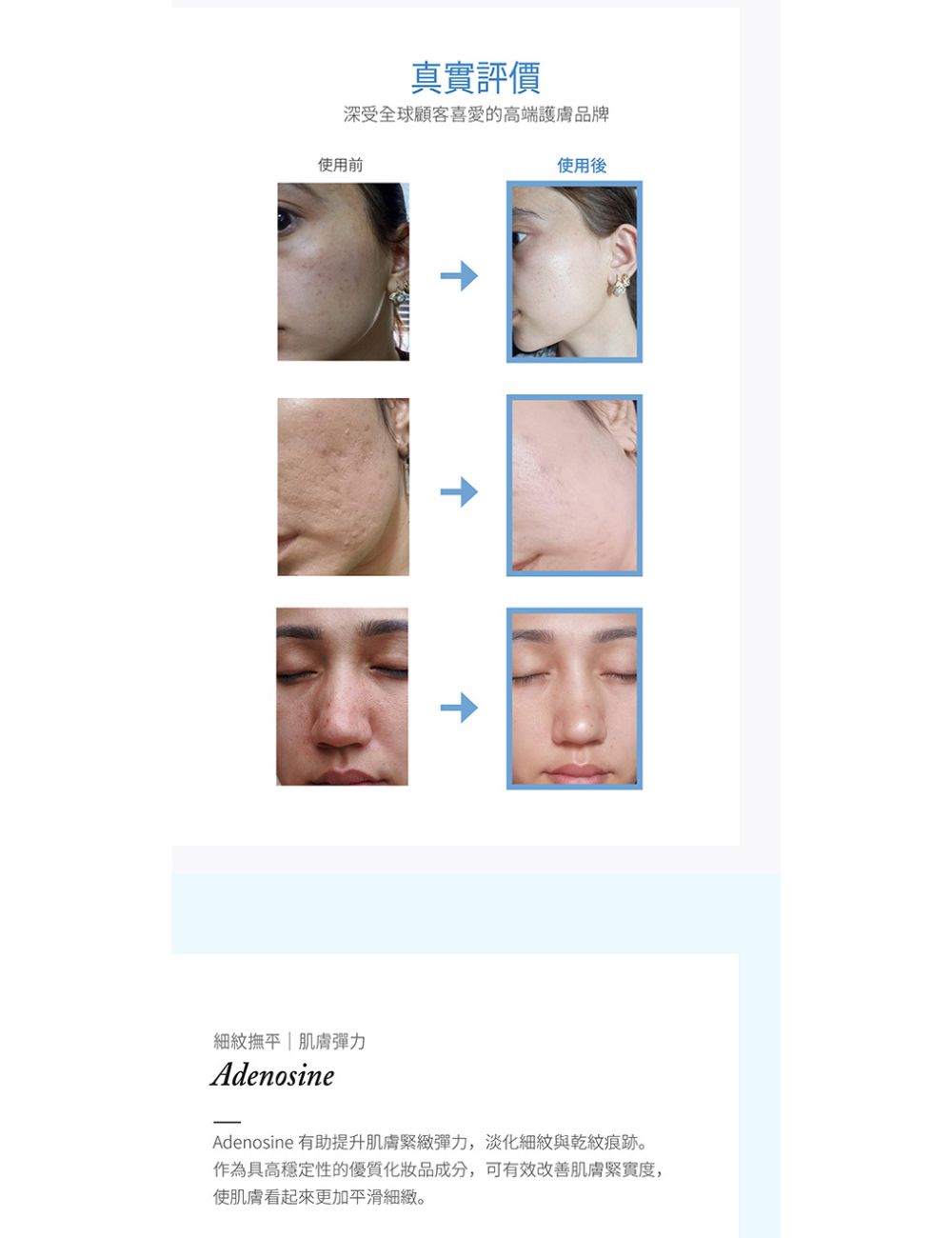 DERMALINE DLEXO PDRN積雪草緊緻青春面膜3入 商品圖
