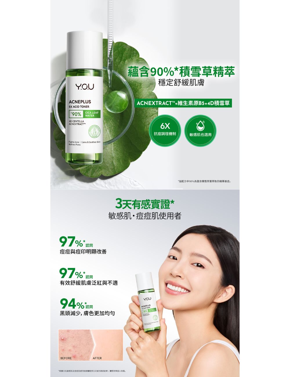 Y.O.U 5重酸煥膚化妝水80ml 商品圖