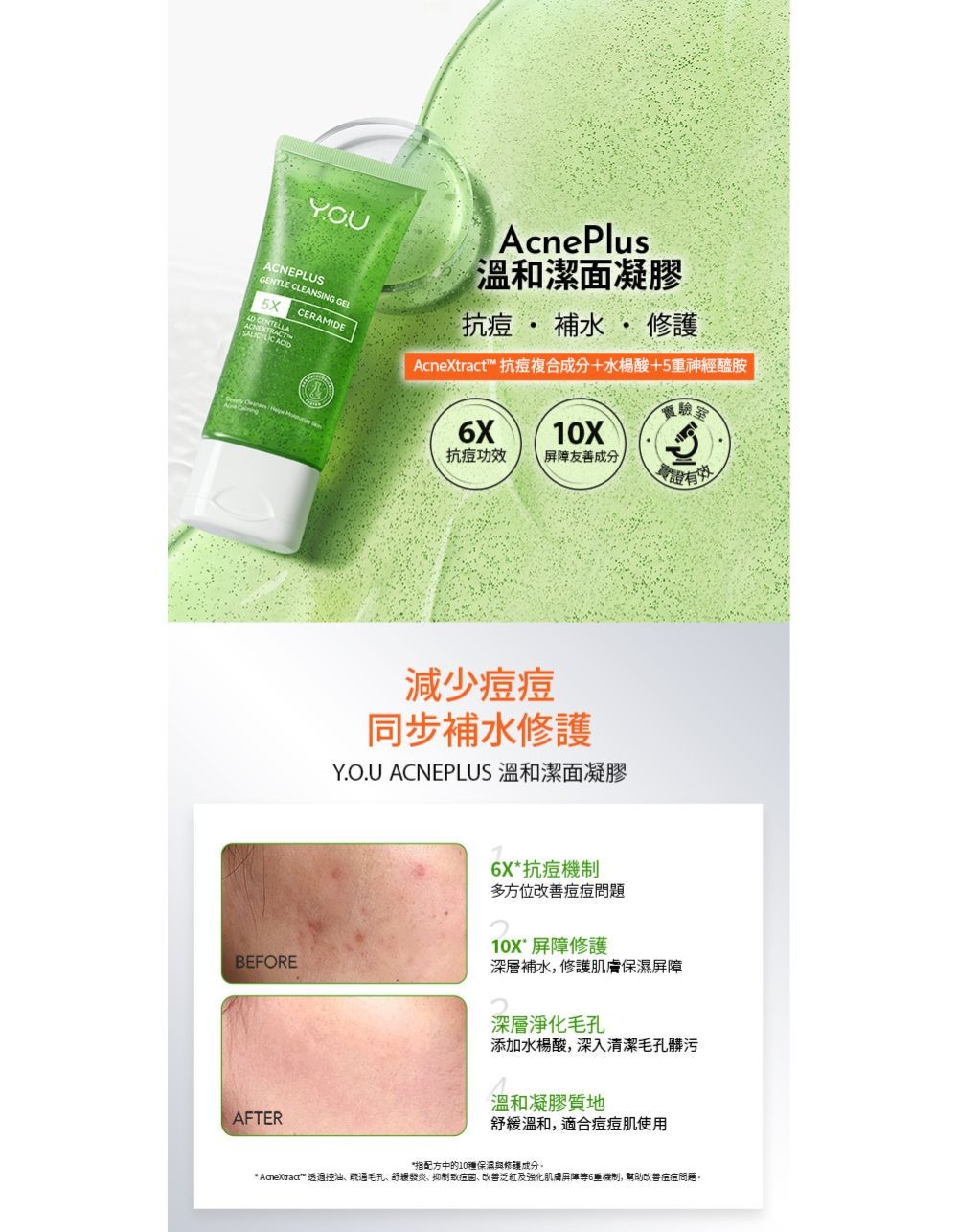 Y.O.U AcnePlus 溫和潔面凝膠100g商品圖