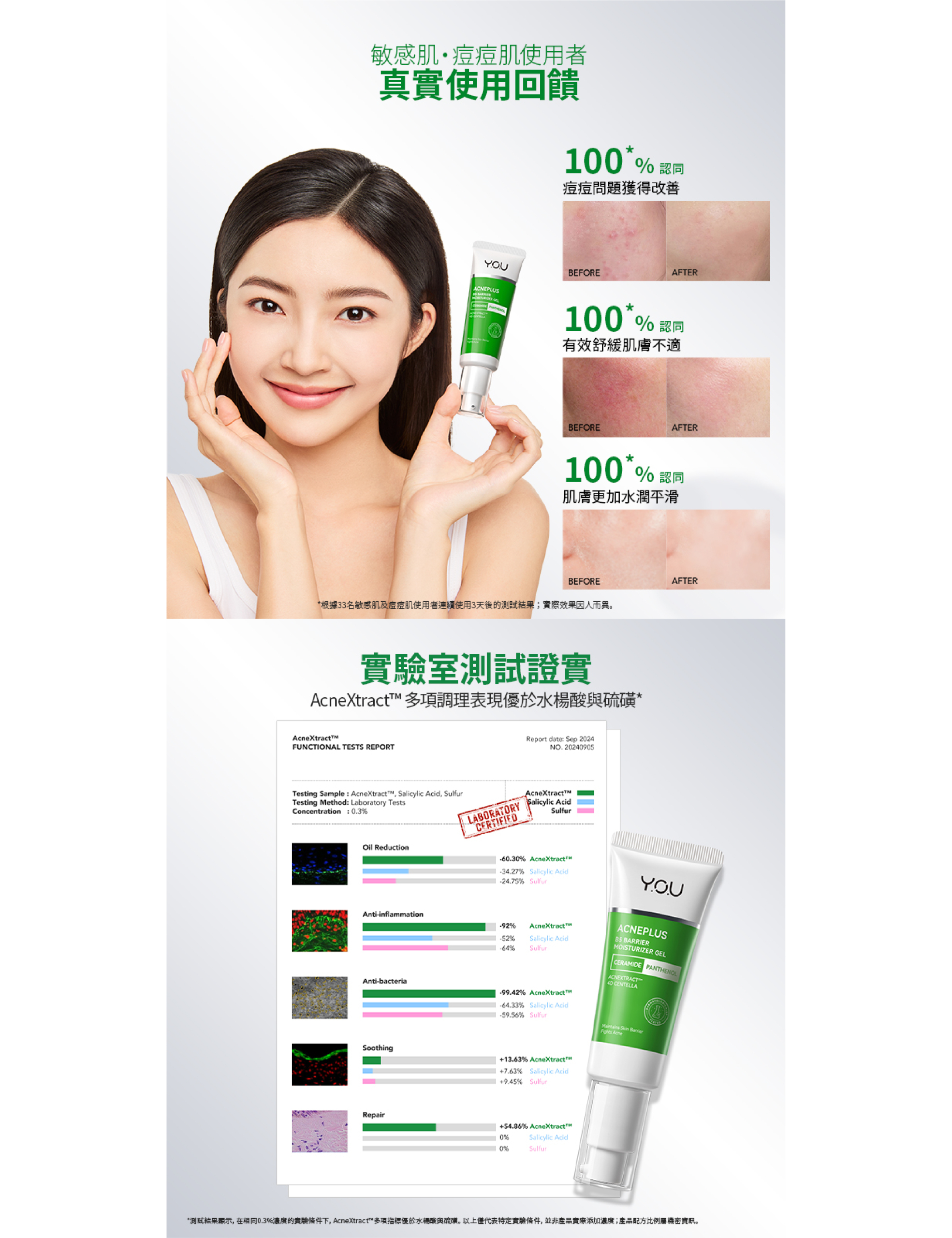 Y.O.U AcnePlus B5修護保濕凝膠30g 產品圖