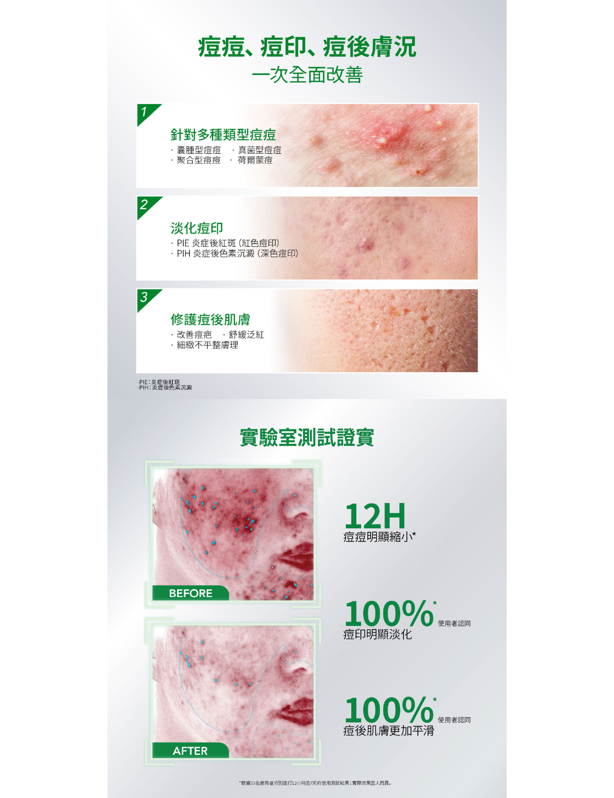 Y.O.U AcnePlus 痘痘局部修護精華15g 商品圖